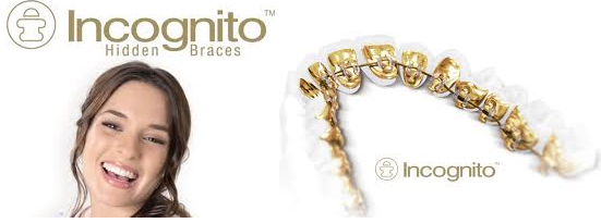 Incognito hidden braces logo with a smiling woman and a lingual braces arch