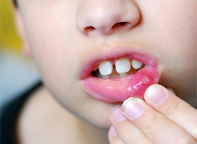 Child pulling down the lower lip to show the inside of the mouth