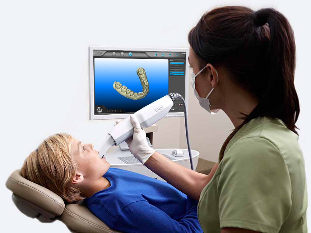 Child having an iTero digital scan of the teeth in the dental chair