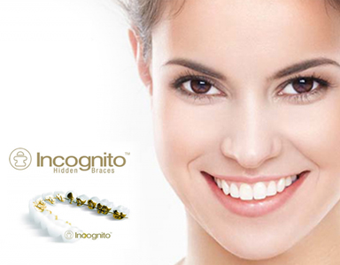 Smiling woman beside the Incognito hidden braces logo