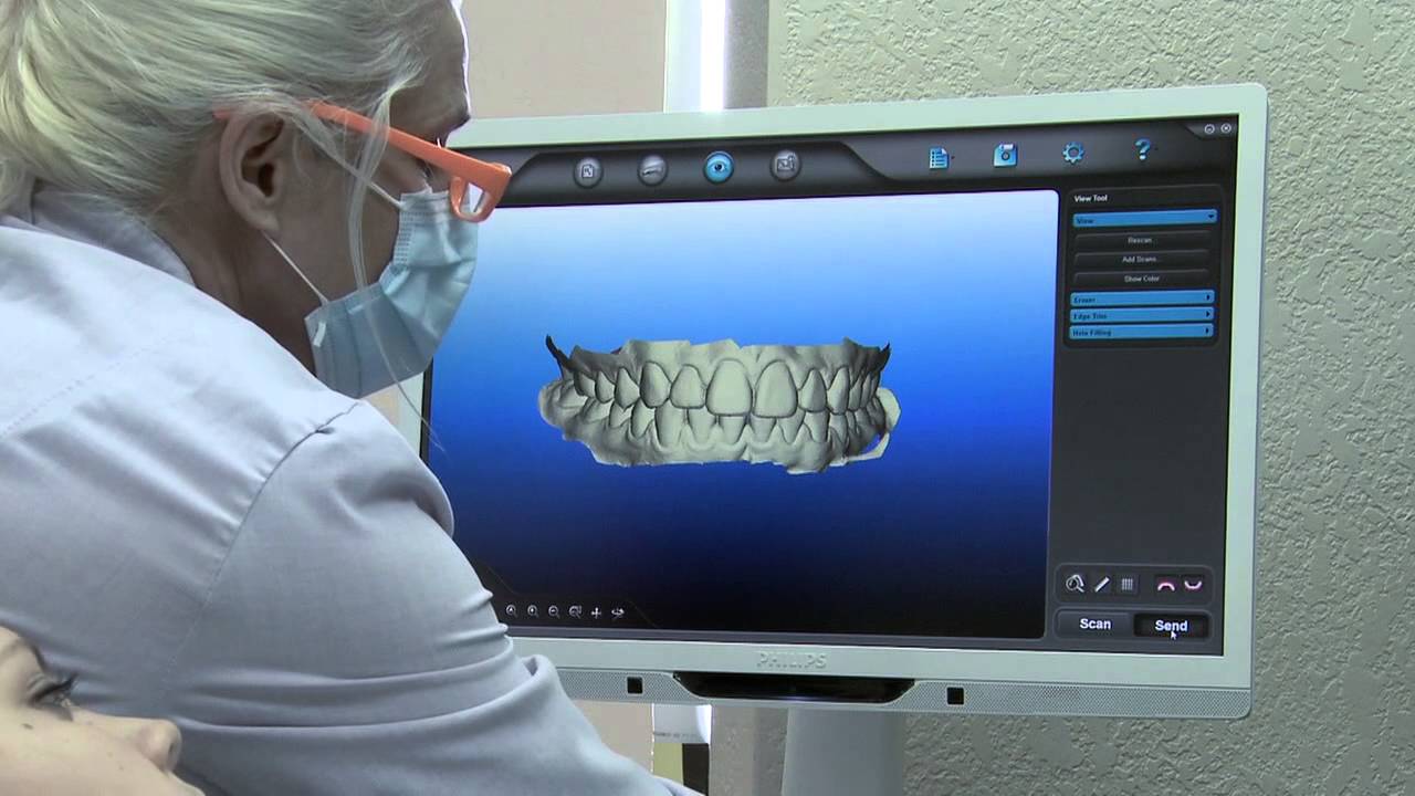 Dental professional viewing a 3D iTero scan of the teeth on a monitor
