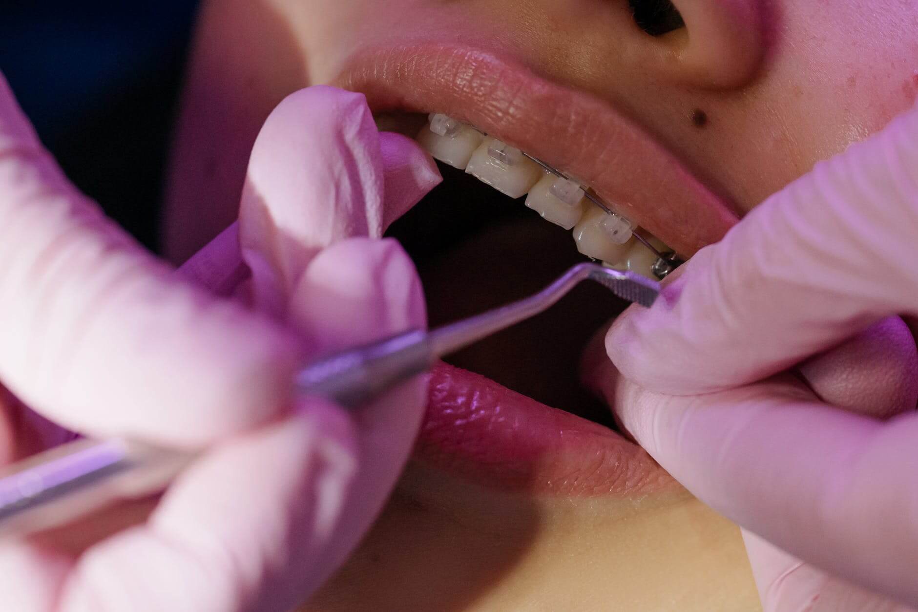 Gloved hands examining teeth with a dental instrument