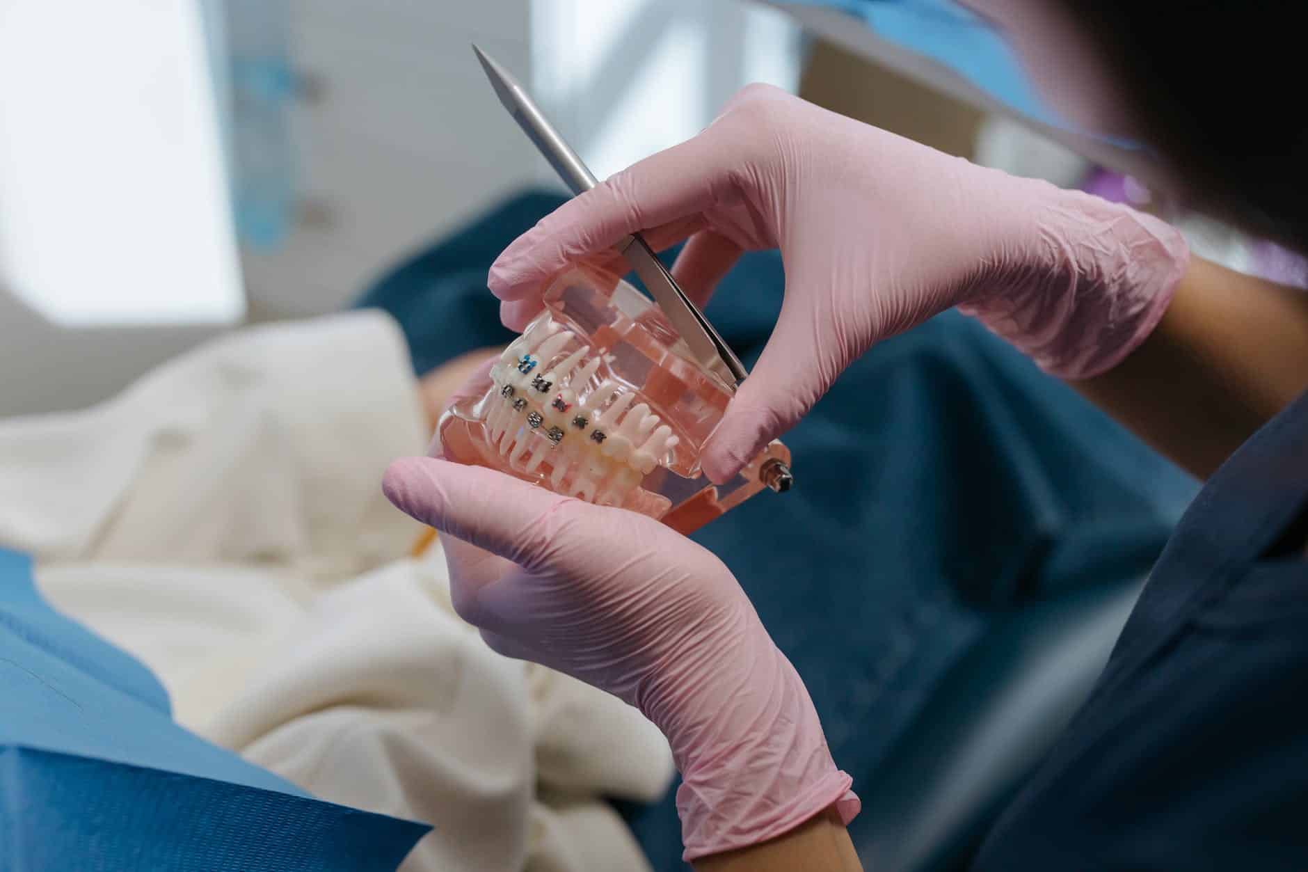 Gloved hands holding a clear aligner over a dental model