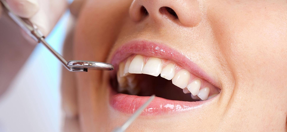Dental instrument held near a smiling mouth
